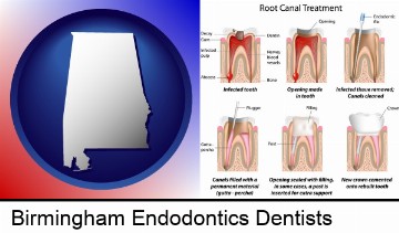 root canal treatment performed by an endodontist in Birmingham, AL