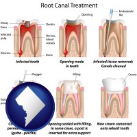 washington-dc map icon and root canal treatment performed by an endodontist