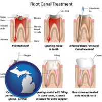 michigan map icon and root canal treatment performed by an endodontist