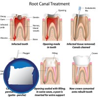 oregon map icon and root canal treatment performed by an endodontist